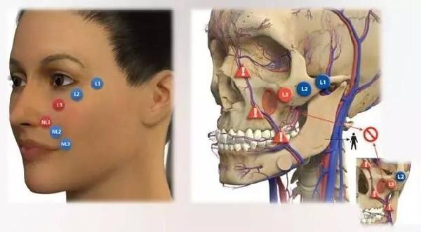 广州做凹陷填充医院有哪些？这几家医院口碑好技术稳！