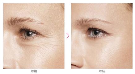 哈尔滨抗衰除皱哪家医院技术好？2025年权威医美机构推荐！