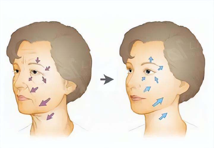 哈尔滨拉皮手术哪家医院好？黑龙江省医院、哈医大四院等权威机构盘点
