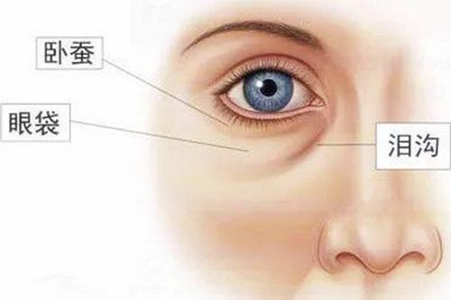 广州做自体脂肪祛泪沟好的医院有哪些？精选5家技术过硬的机构
