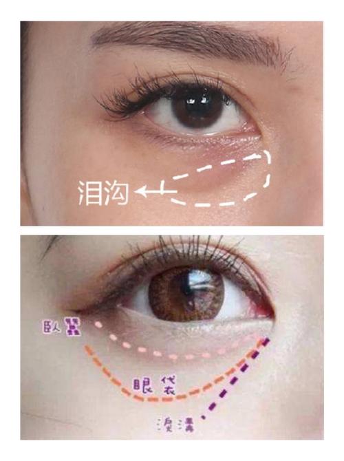 深圳祛泪沟医生排名前十的医院，专业医生名单及坐诊机构