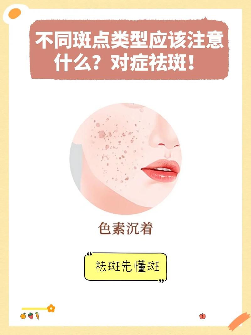 大同激光祛斑哪家医院效果好？本地五大专业医美机构推荐