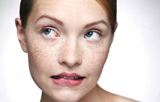 大庆做激光祛斑好的医院有哪些？天姿、彤铭医疗美容等专业度高~