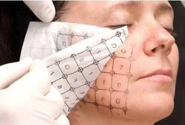 平顶山哪些医院做眼部热玛吉效果好？6家医院实力对比